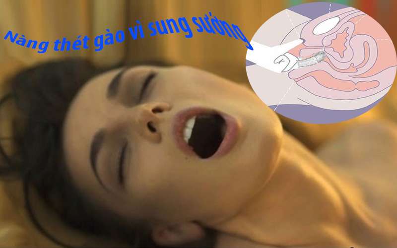 Thu dam bang bao cao su ngon tay G-spot